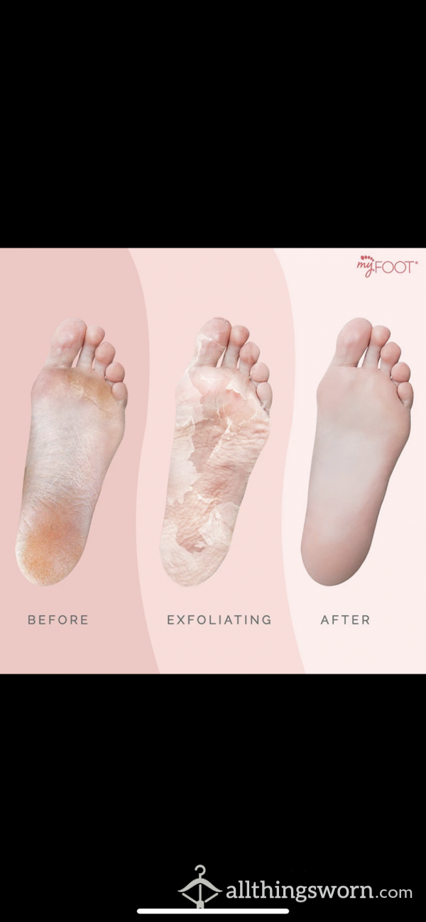 DEAD SKIN FOOT MASK