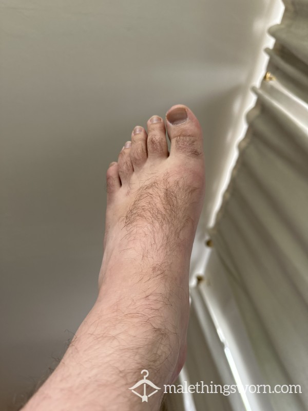 Hairy Feet Pics- 5 Pictures